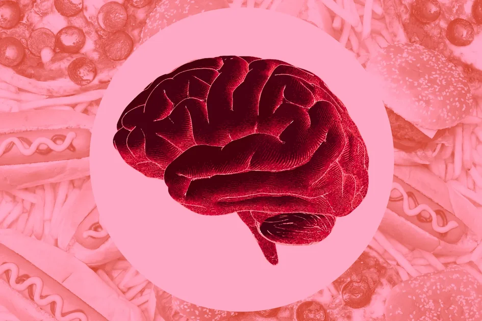 A brain illustration over a background of various processed foods