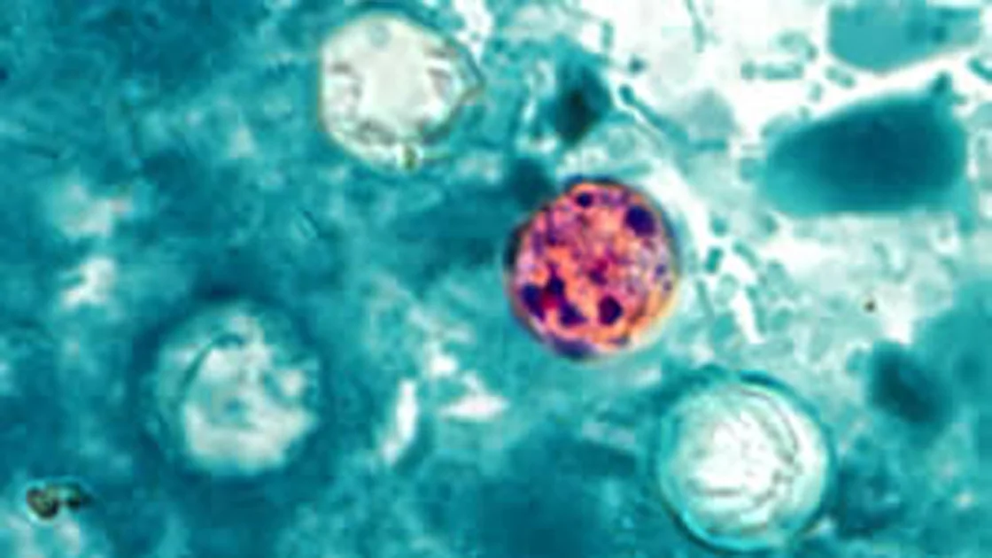 Microscopic image of cyclospora cayetanensis